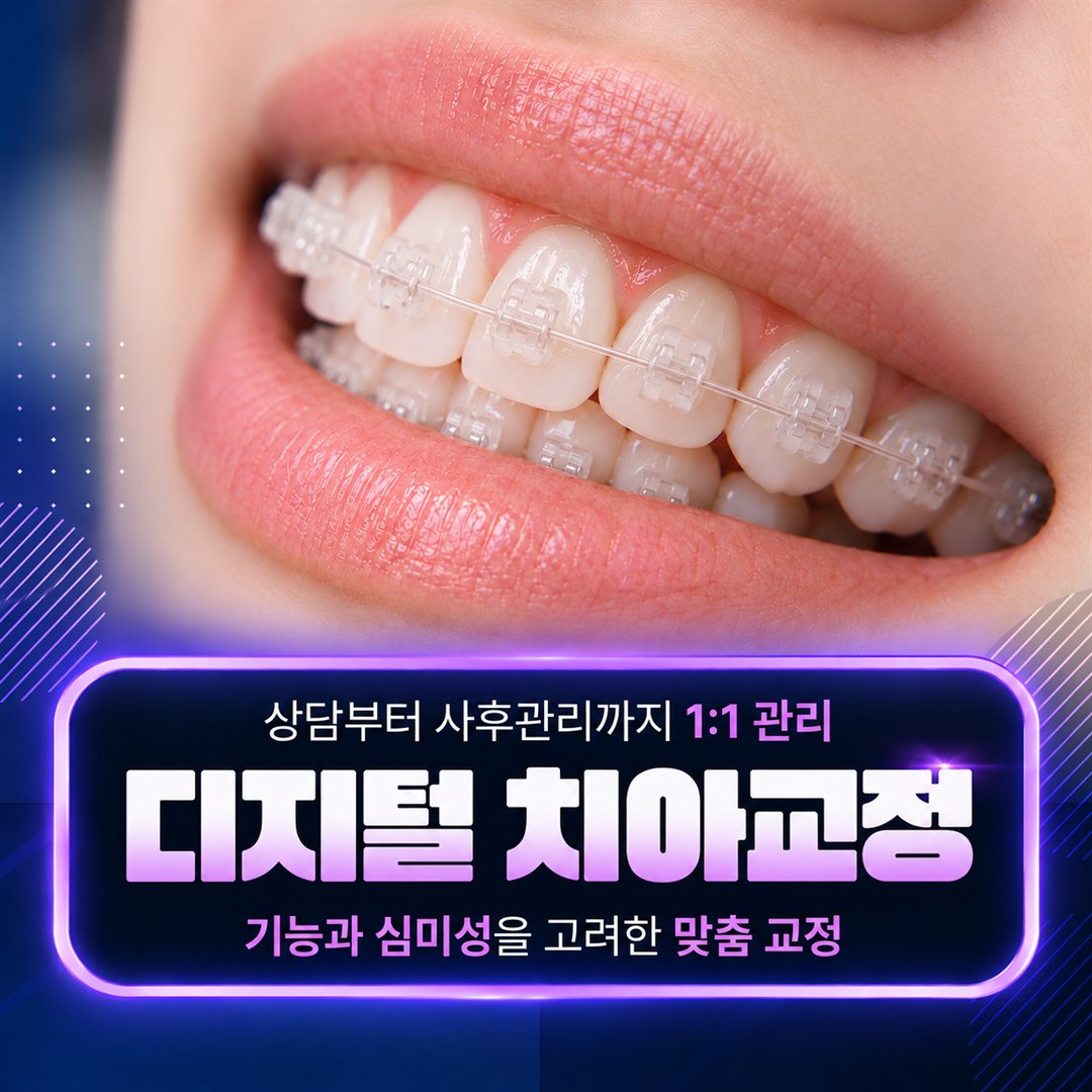 강서구 치과 서울라이프치과의원 디지털 치아교정 - 상담부터 사후관리까지 1:1 관리, 기능과 심미성을 고려한 맞춤 교정